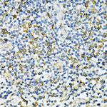 UVRAG Antibody in Immunohistochemistry (Paraffin) (IHC (P))