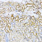 UVRAG Antibody in Immunohistochemistry (Paraffin) (IHC (P))