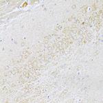 UVRAG Antibody in Immunohistochemistry (Paraffin) (IHC (P))