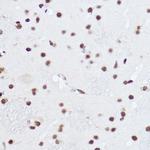 SART1 Antibody in Immunohistochemistry (Paraffin) (IHC (P))