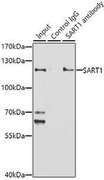 SART1 Antibody in Immunoprecipitation (IP)