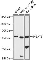 MGAT2 Antibody in Western Blot (WB)