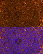 FAM65B Antibody in Immunohistochemistry (Paraffin) (IHC (P))