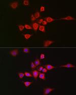 METTL4 Antibody in Immunocytochemistry (ICC/IF)