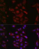 METTL4 Antibody in Immunocytochemistry (ICC/IF)