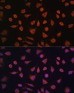 PFKFB2 Antibody in Immunocytochemistry (ICC/IF)