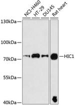 HIC1 Antibody in Western Blot (WB)