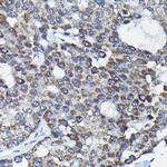 RGS14 Antibody in Immunohistochemistry (Paraffin) (IHC (P))