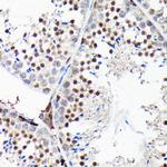 RGS14 Antibody in Immunohistochemistry (Paraffin) (IHC (P))