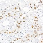 Phospho-c-Jun (Ser73) Antibody in Immunohistochemistry (Paraffin) (IHC (P))