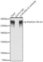 Phospho-RNA pol II CTD (Ser2) Antibody in Immunoprecipitation (IP)