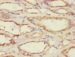 ACAT1 Antibody in Immunohistochemistry (Paraffin) (IHC (P))