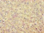 ACAT1 Antibody in Immunohistochemistry (Paraffin) (IHC (P))