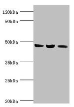 ACAT1 Antibody in Western Blot (WB)