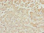 AKR7A2 Antibody in Immunohistochemistry (Paraffin) (IHC (P))