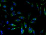 SERCA2 ATPase Antibody in Immunocytochemistry (ICC/IF)