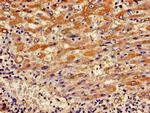 SERCA2 ATPase Antibody in Immunohistochemistry (Paraffin) (IHC (P))