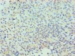 CLIC1 Antibody in Immunohistochemistry (Paraffin) (IHC (P))