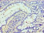 CLIC1 Antibody in Immunohistochemistry (Paraffin) (IHC (P))