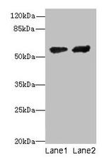 CYP17A1 Antibody in Western Blot (WB)