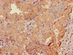 GABRB3 Antibody in Immunohistochemistry (Paraffin) (IHC (P))