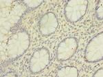 hnRNP L Antibody in Immunohistochemistry (Paraffin) (IHC (P))