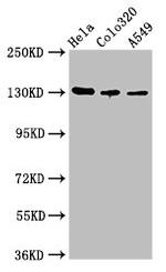CD51 Antibody in Western Blot (WB)