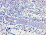 KCNN4 Antibody in Immunohistochemistry (Paraffin) (IHC (P))