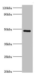 KCNN4 Antibody in Western Blot (WB)