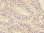 MTHFD2 Antibody in Immunohistochemistry (Paraffin) (IHC (P))