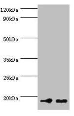 NCBP2 Antibody in Western Blot (WB)