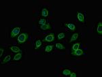 PFKM Antibody in Immunocytochemistry (ICC/IF)