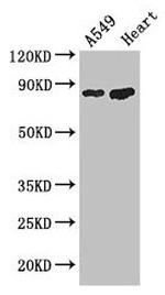 PFKM Antibody in Western Blot (WB)