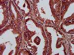 PLA1A Antibody in Immunohistochemistry (Paraffin) (IHC (P))