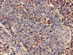 PLS3 Antibody in Immunohistochemistry (Paraffin) (IHC (P))