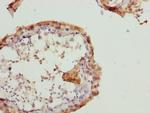 RAB5B Antibody in Immunohistochemistry (Paraffin) (IHC (P))