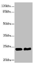 RAB5B Antibody in Western Blot (WB)