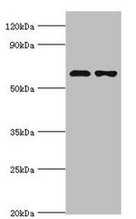 SOAT1 Antibody in Western Blot (WB)