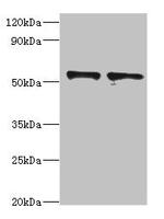 SPTLC1 Antibody in Western Blot (WB)