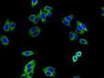 TGFBR1 Antibody in Immunocytochemistry (ICC/IF)