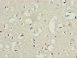 RFP2 Antibody in Immunohistochemistry (Paraffin) (IHC (P))