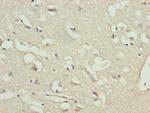 BNP Antibody in Immunohistochemistry (Paraffin) (IHC (P))