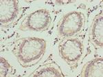 PLA2G7 Antibody in Immunohistochemistry (Paraffin) (IHC (P))