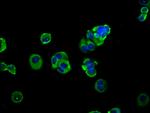 ADAM8 Antibody in Immunocytochemistry (ICC/IF)