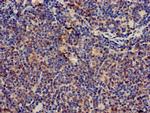 CD3z Antibody in Immunohistochemistry (Paraffin) (IHC (P))