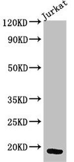 CD3z Antibody in Western Blot (WB)