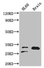 TPI1 Antibody in Western Blot (WB)