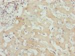 ITPK1 Antibody in Immunohistochemistry (Paraffin) (IHC (P))