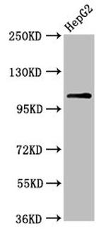 USP4 Antibody in Western Blot (WB)