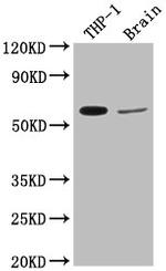 COL9A2 Antibody in Western Blot (WB)